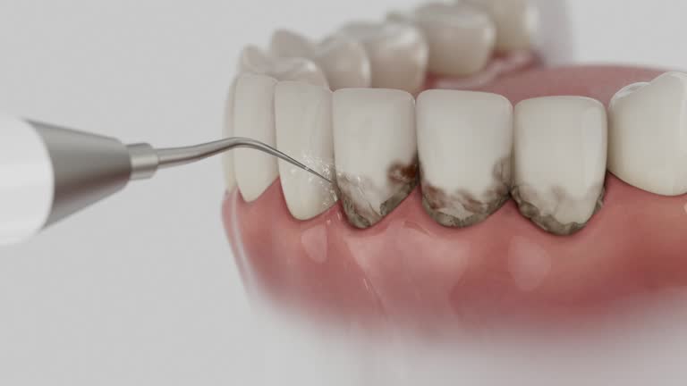 Reliable Invisalign Clear Aligners contractor in Descanso, CA by Smile Center Dentistry